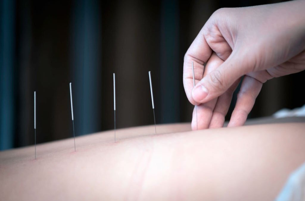 Aesthetic Acupuncture: A natural “anti-aging treatment.